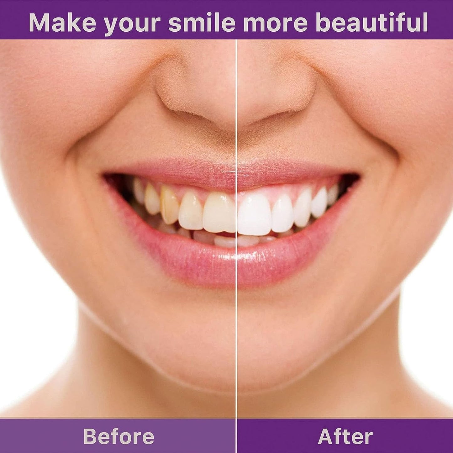HISMILE V34 Teeth Colour Correct Serum